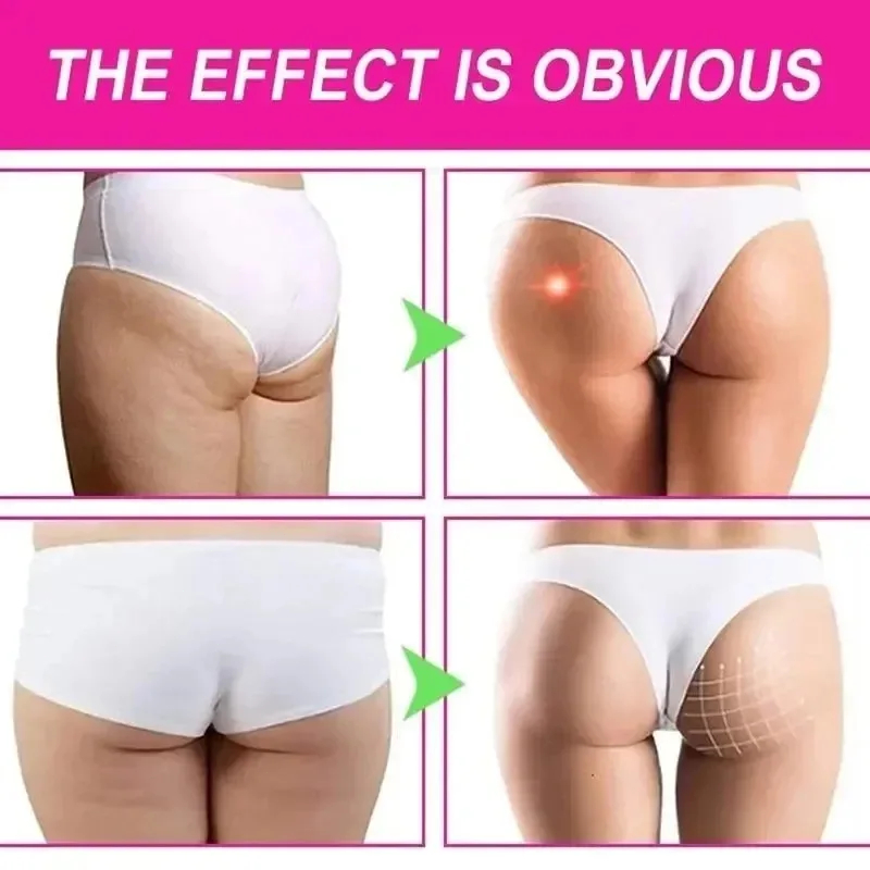 Kalça Sıkılaştırıcı Krem Cilt  - Lifted Nutrition & Fitness Reviews incelemesi ve fiyatı